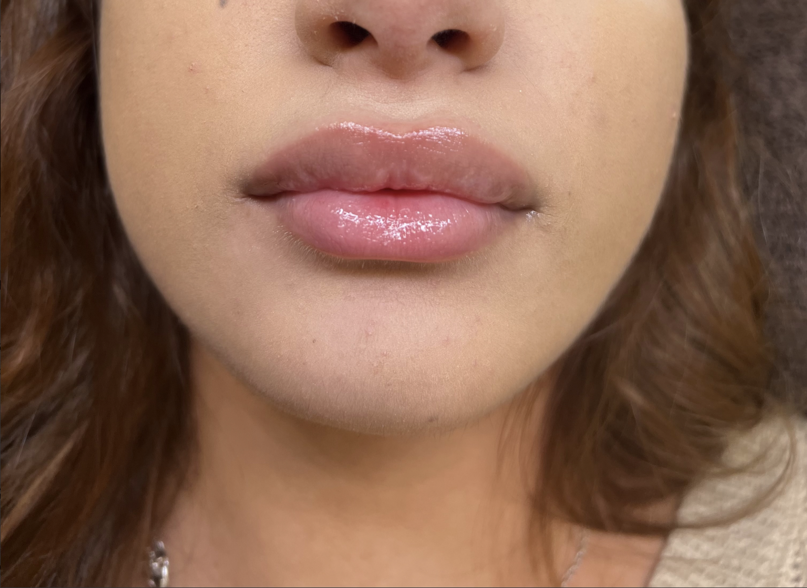 Beauty Sweden by Petra - Aesthetic treatments